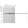 KD-Validated USP14 Rabbit mAb (20 μl)