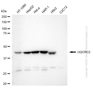 KD-Validated UQCRC2 Rabbit mAb (20 μl)