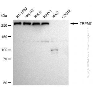 KD-Validated TRPM7 Rabbit mAb (20 μl)