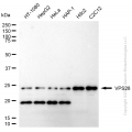KD-Validated VPS28 Rabbit mAb (20 μl)