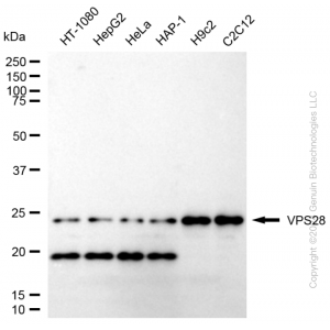 KD-Validated VPS28 Rabbit mAb (20 μl)