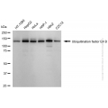 KD-Validated UBE4B Rabbit mAb (20 μl)