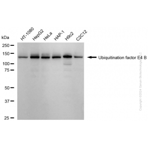 KD-Validated UBE4B Rabbit mAb (20 μl)