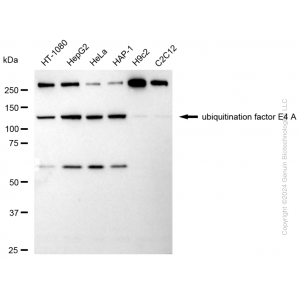 KD-Validated UBE4A Rabbit mAb (20 μl)