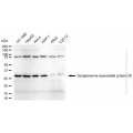 KD-Validated SNAP29 Rabbit mAb (20 μl)