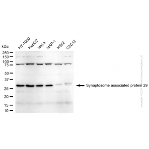 KD-Validated SNAP29 Rabbit mAb (20 μl)
