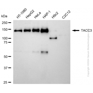 KD-Validated TACC3 Rabbit mAb (20 μl)