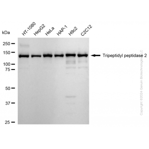 KD-Validated TPP2 Rabbit mAb (20 μl)