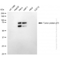 KD-Validated TP73 Rabbit mAb (20 μl)