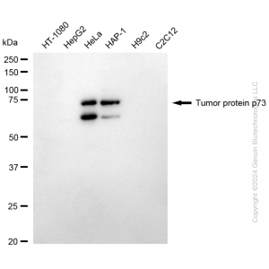 KD-Validated TP73 Rabbit mAb (20 μl)