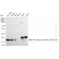 KD-Validated TNFRSF12A Rabbit mAb (20 μl)