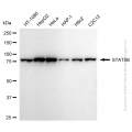 KD-Validated STAT5B Rabbit mAb (20 μl)