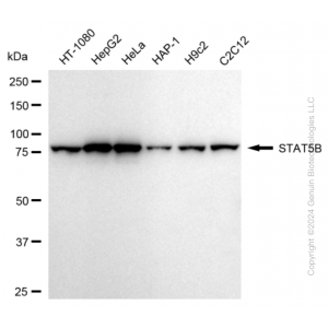 KD-Validated STAT5B Rabbit mAb (20 μl)