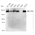 KD-Validated ZEB1 Rabbit mAb (20 μl)