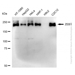 KD-Validated ZEB1 Rabbit mAb (20 μl)