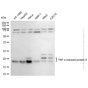 KD-Validated TNFAIP8 Rabbit mAb (20 μl)