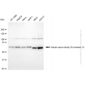 KD-Validated SLC25A12 Rabbit mAb (20 μl)