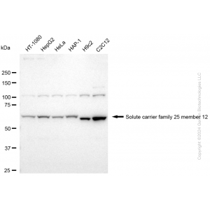 KD-Validated SLC25A12 Rabbit mAb (20 μl)