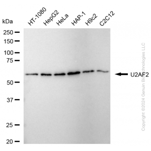 KD-Validated U2AF2 Rabbit mAb (20 μl)