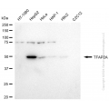 KD-Validated TFAP2A Rabbit mAb (20 μl)