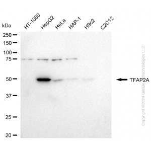 KD-Validated TFAP2A Rabbit mAb (20 μl)