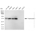 KD-Validated TPM1 Rabbit mAb (20 μl)