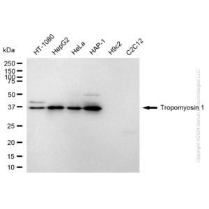 KD-Validated TPM1 Rabbit mAb (20 μl)