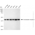 KD-Validated SSTR5 Rabbit mAb (20 μl)
