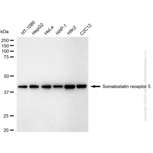 KD-Validated SSTR5 Rabbit mAb (20 μl)