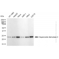 KD-Validated SOD2 Rabbit mAb (20 μl)