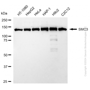 KD-Validated SMC3 Rabbit mAb (20 μl)