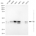 KD-Validated TIA1 Rabbit mAb (20 μl)