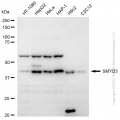 KD-Validated SMYD3 Rabbit mAb (20 μl)