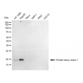 KD-Validated FTH1 Rabbit mAb (20 μl)