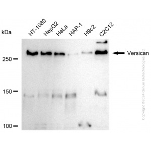 KD-Validated VCAN Rabbit mAb (20 μl)