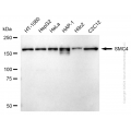 KD-Validated SMC4 Rabbit mAb (20 μl)