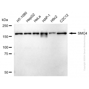 KD-Validated SMC4 Rabbit mAb (20 μl)