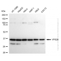 KD-Validated VPS26 Rabbit mAb (20 μl)