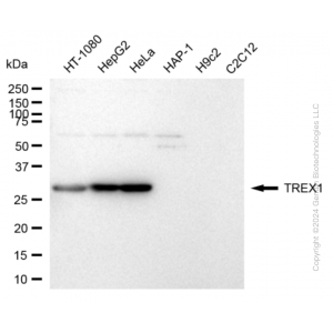 KD-Validated TREX1 Rabbit mAb (20 μl)