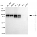 KD-Validated SUN1 Rabbit mAb (20 μl)