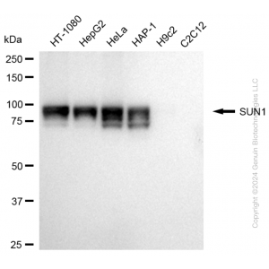 KD-Validated SUN1 Rabbit mAb (20 μl)