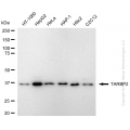 KD-Validated TARBP2 Rabbit mAb (20 μl)