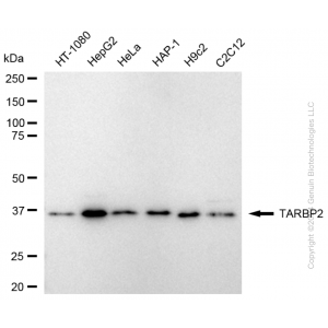 KD-Validated TARBP2 Rabbit mAb (20 μl)