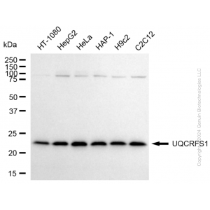 KD-Validated UQCRFS1 Rabbit mAb (20 μl)
