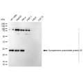 KD-Validated SNAP25 Rabbit mAb (20 μl)