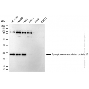 KD-Validated SNAP25 Rabbit mAb (20 μl)