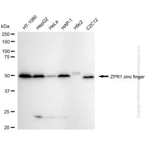 KD-Validated ZPR1 Rabbit mAb (20 μl)