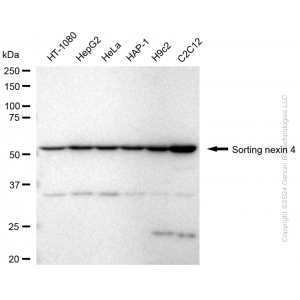 KD-Validated SNX4 Rabbit mAb (20 μl)