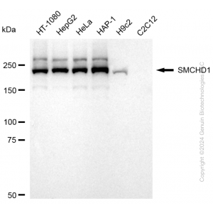 KD-Validated SMCHD1 Rabbit mAb (20 μl)