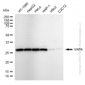 KD-Validated VAPA Rabbit mAb (20 μl)